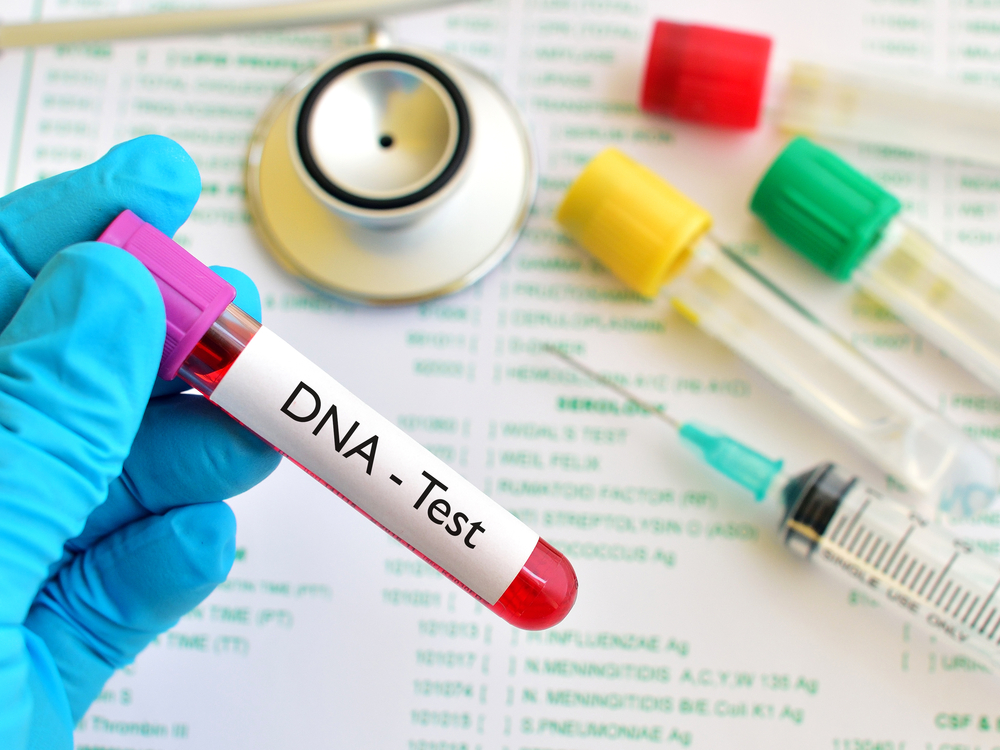 DNA-test